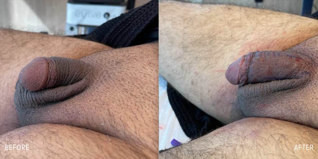 Patient before and after