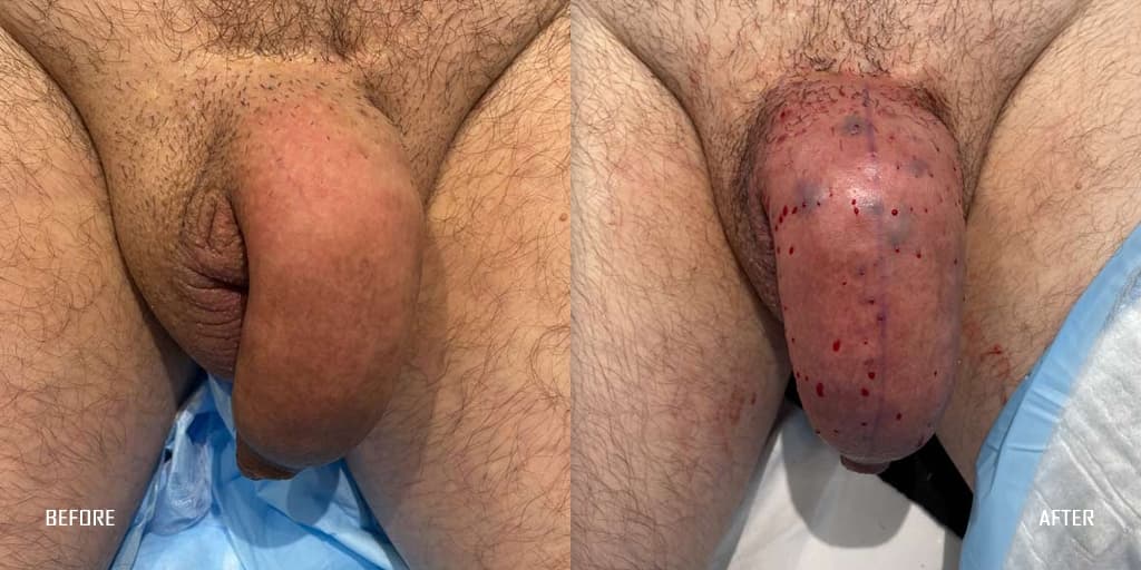 Patient before and after