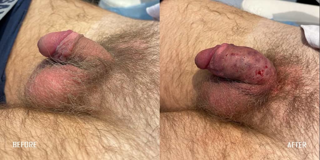 Patient before and after