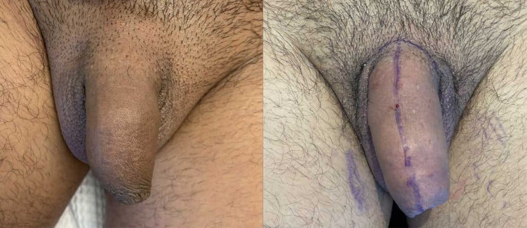Patient before and after