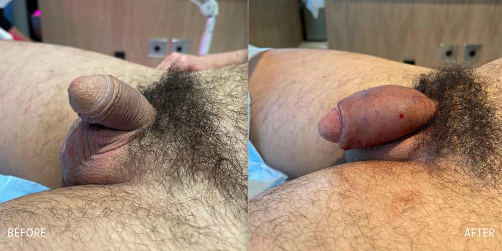 Patient before and after