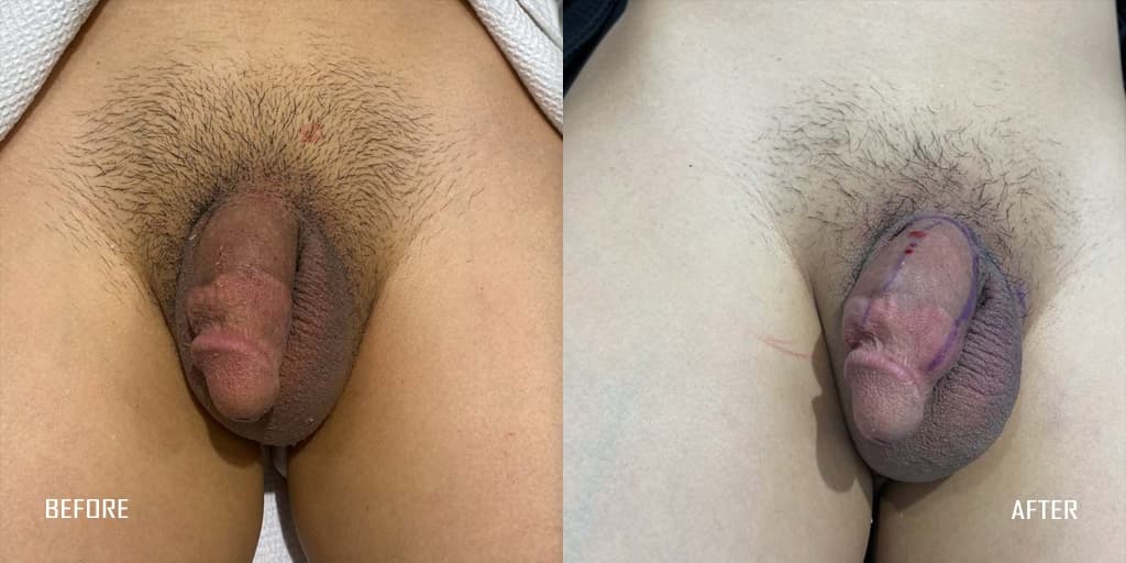 Patient before and after