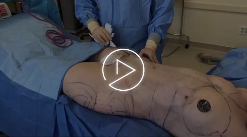Dr. Jason Emer, board-certified dermatologist who performs Supermodel Lipo