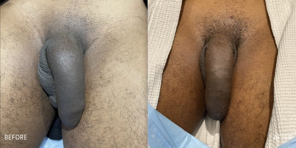 Patient before and after