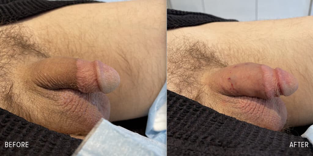 Patient before and after