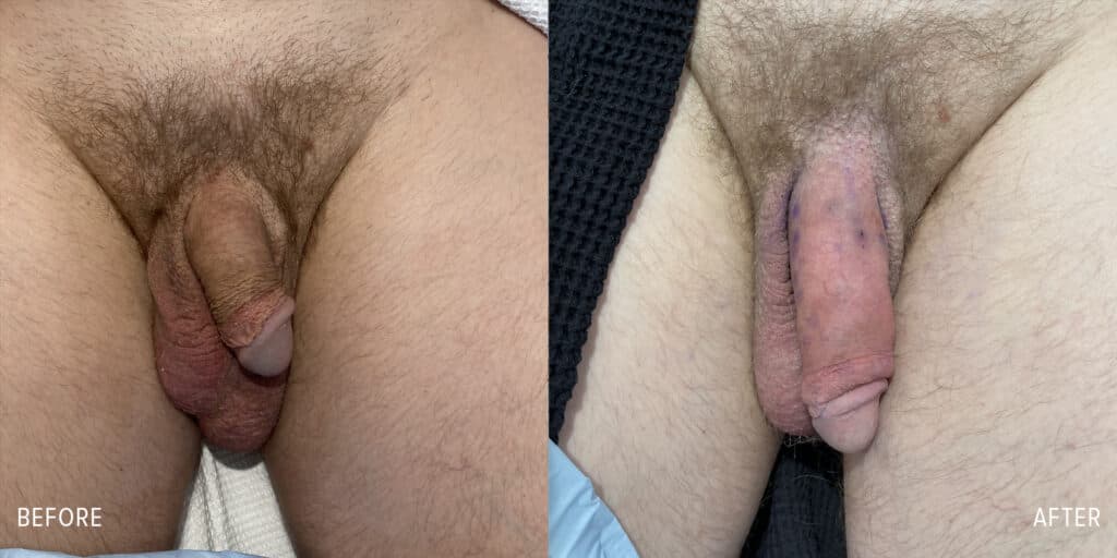 Patient before and after