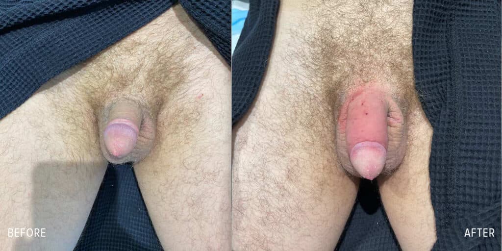 Patient before and after