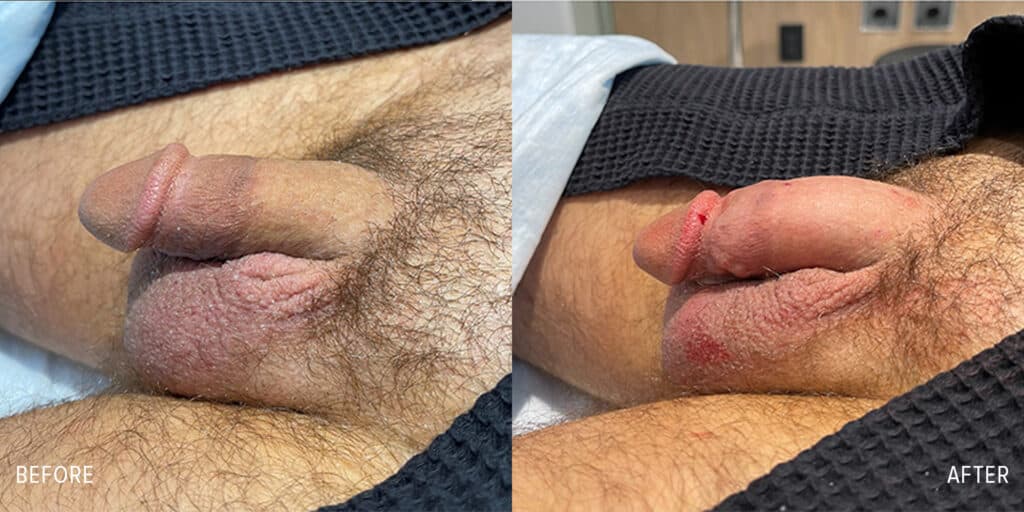 Patient before and after