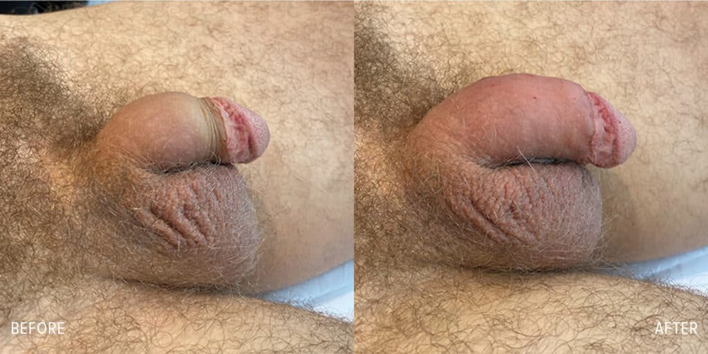 Patient before and after