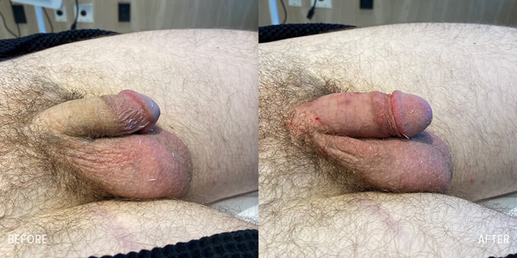 Patient before and after
