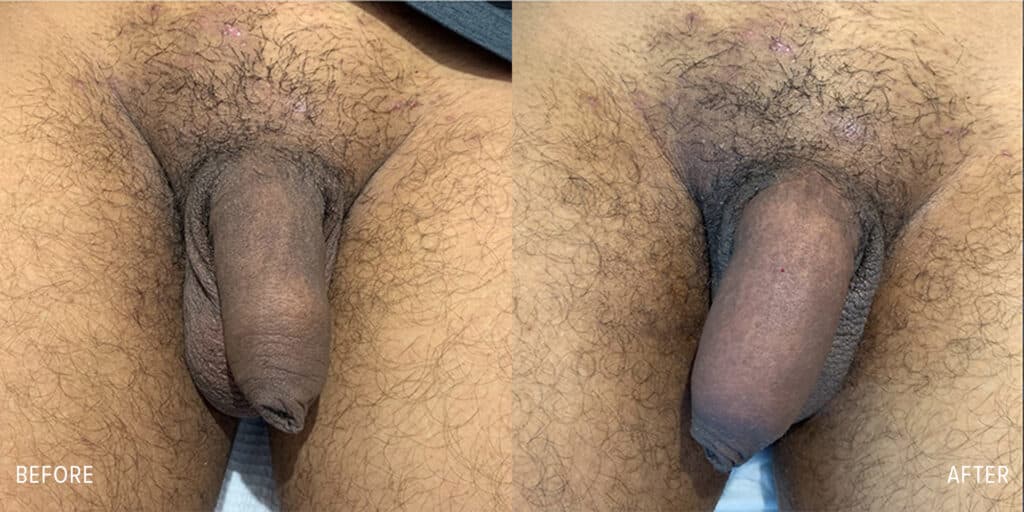Patient before and after