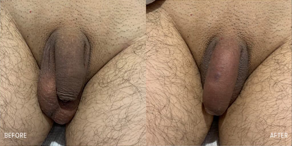 Patient before and after
