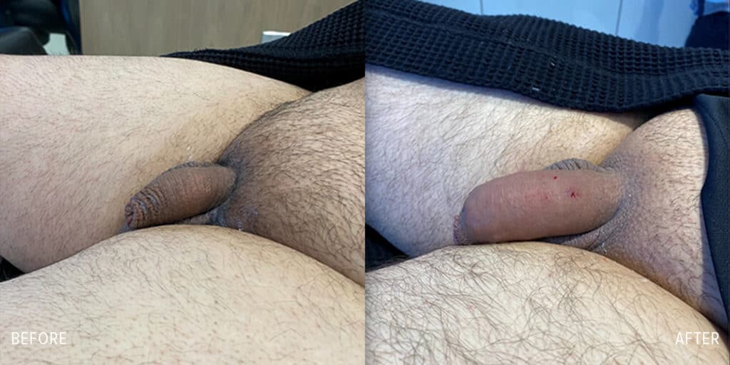 Patient before and after