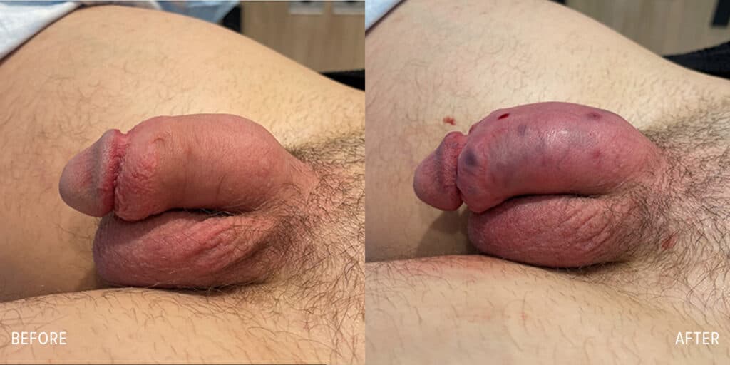 Patient before and after