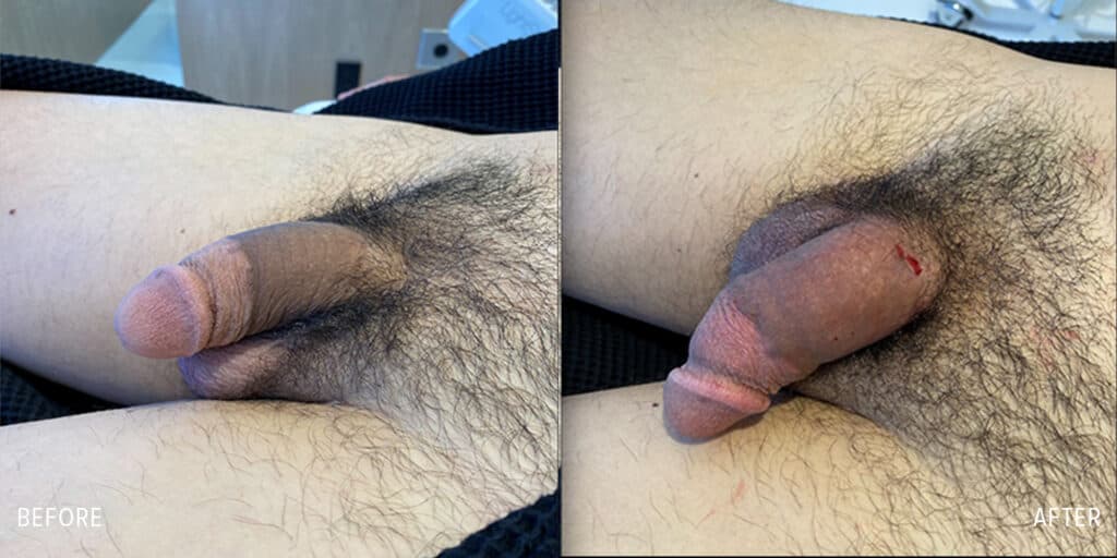 Patient before and after