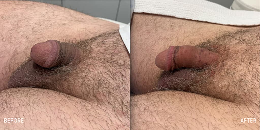 Patient before and after