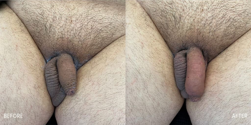 Patient before and after