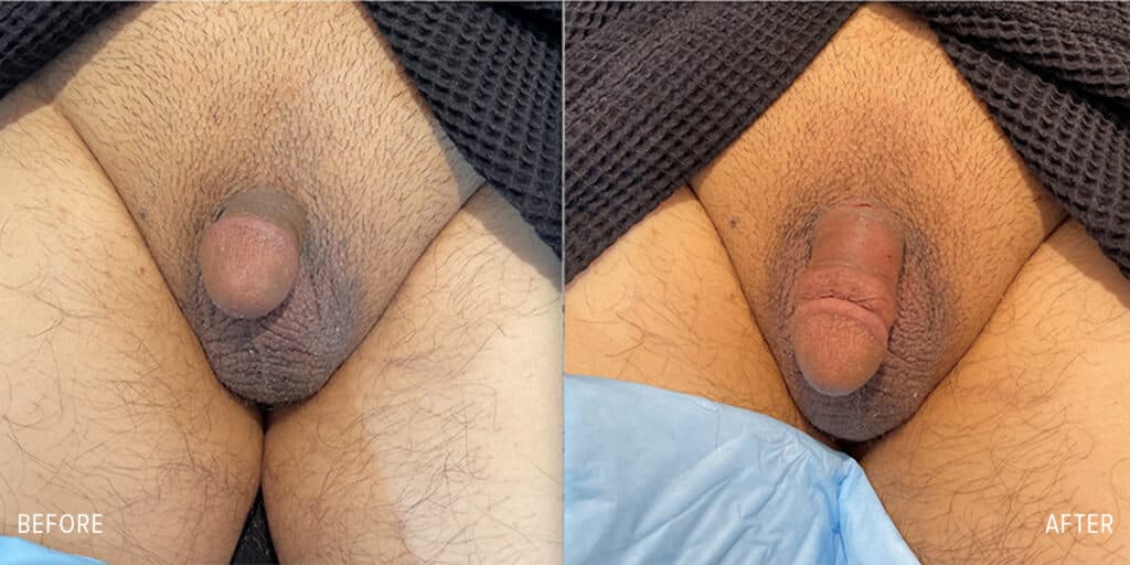Patient before and after