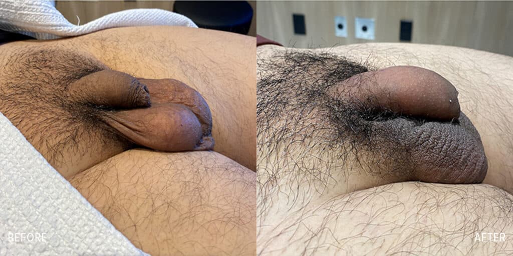Patient before and after