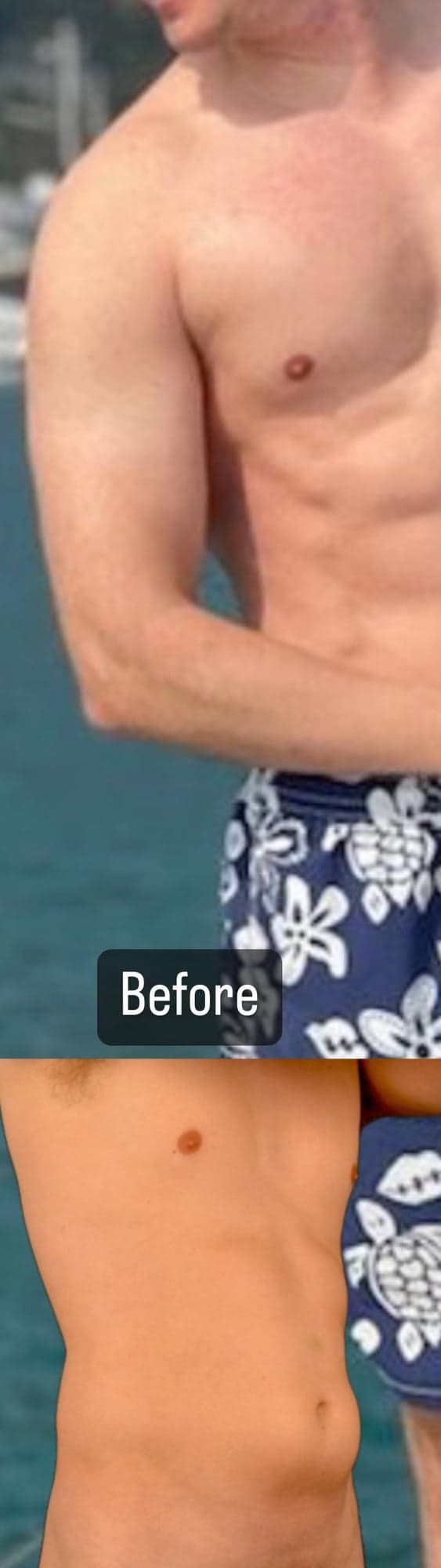 MAXORIS Gladiator Lipo — Before